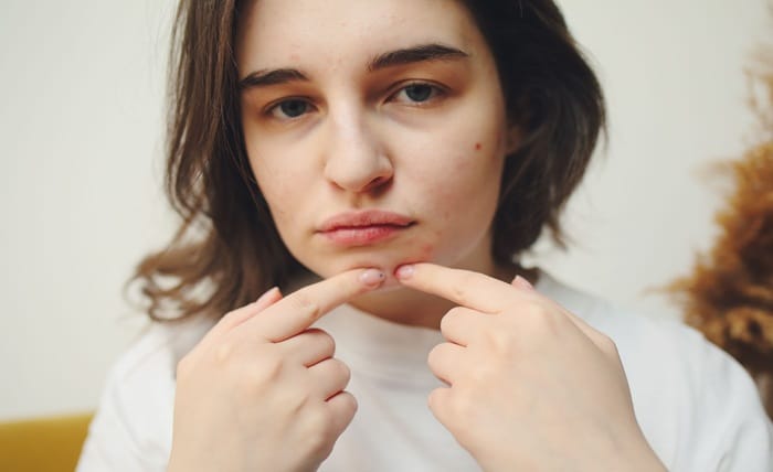 Dr. Pimple Popper Tackles